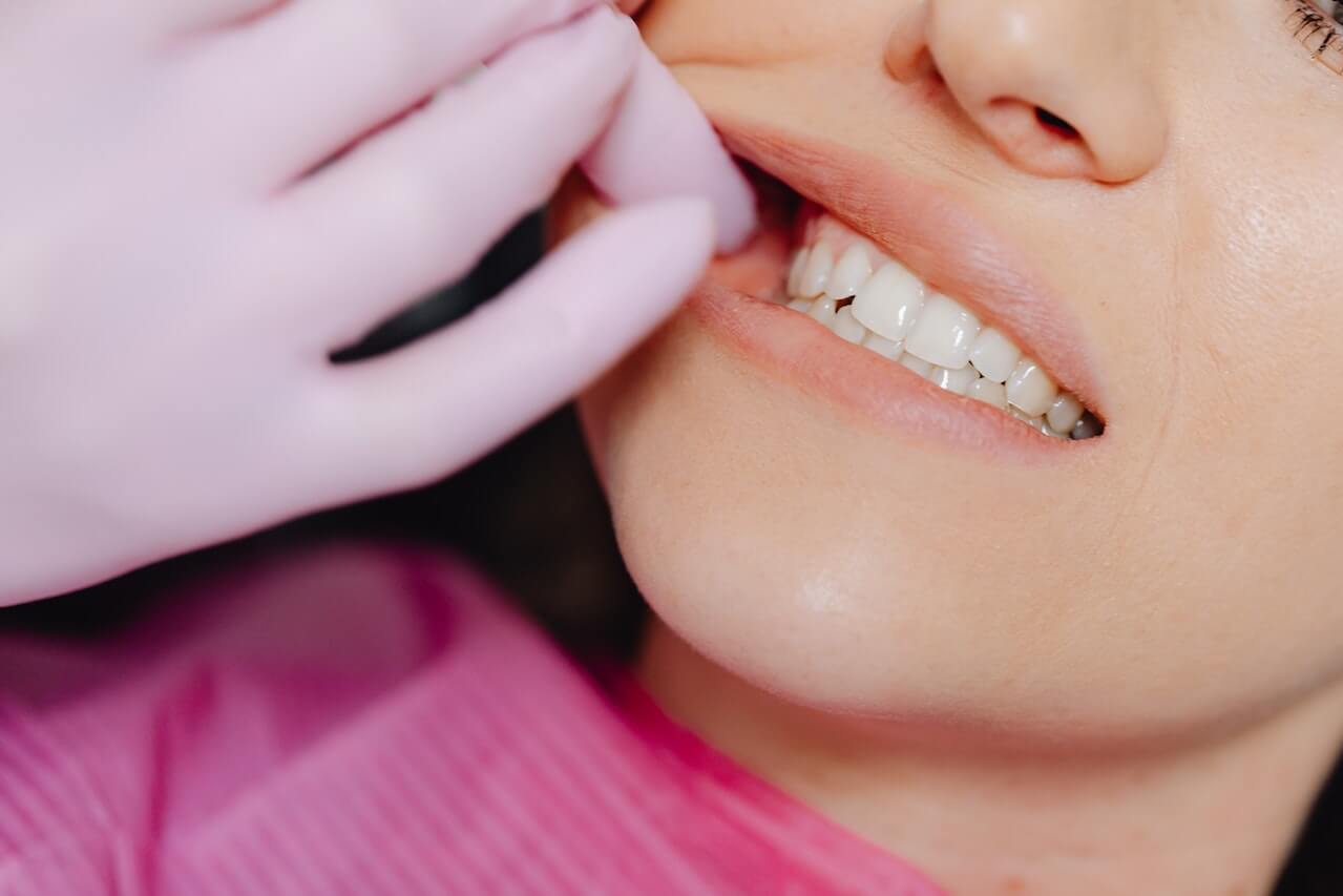 מה הן השיטות ליישור שיניים?
