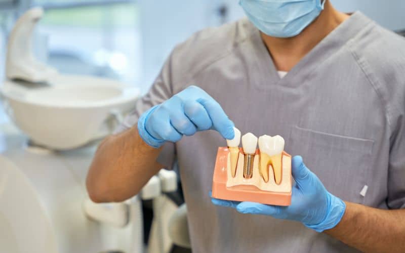 השתלת שיניים בלייזר - כיצד תורם הלייזר לביצוע ההשתלה